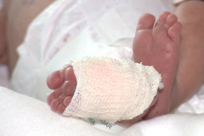 Čudež iz ljubljanske porodnišnice: rešili Emo, tehtala komaj 390 gramov