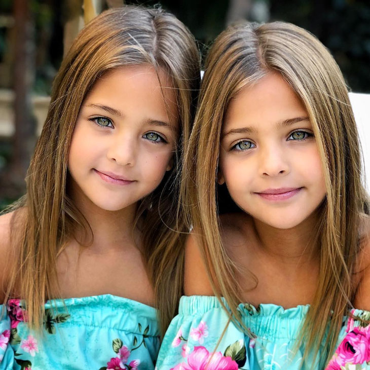 Identical Twin Girls Have Grown To Be Called The Most