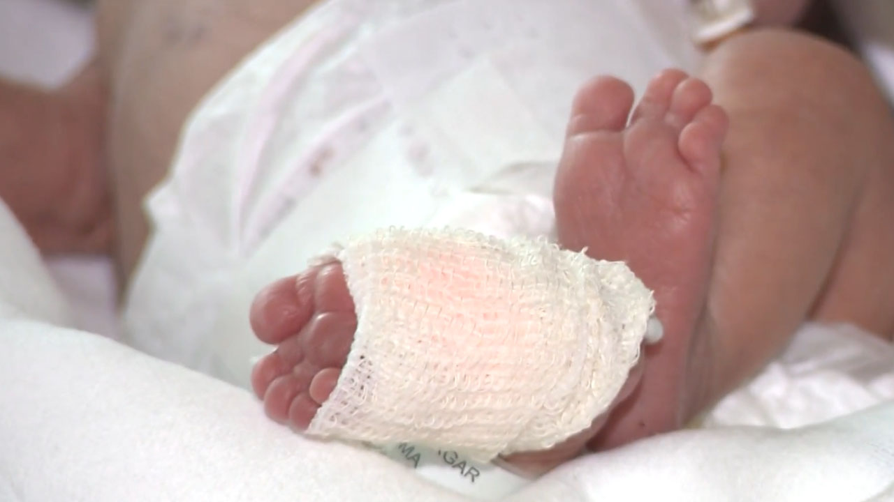 V UKC Ljubljana se je rodila deklica Ema, težka komaj 390 gramov